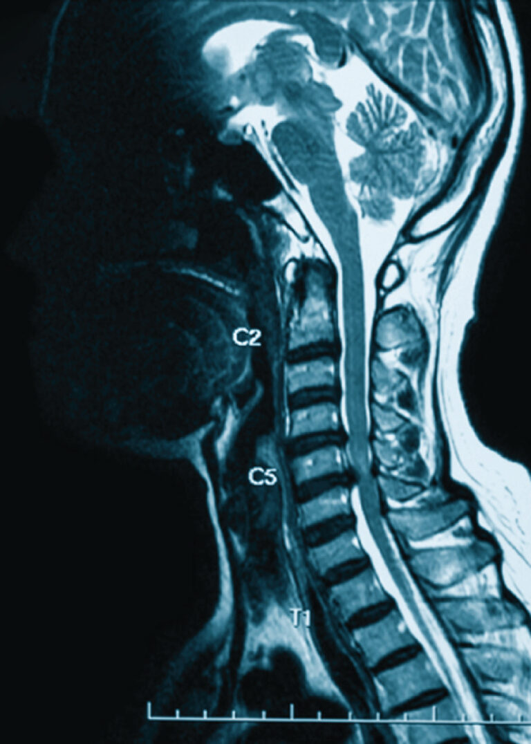 3T contrast MRI