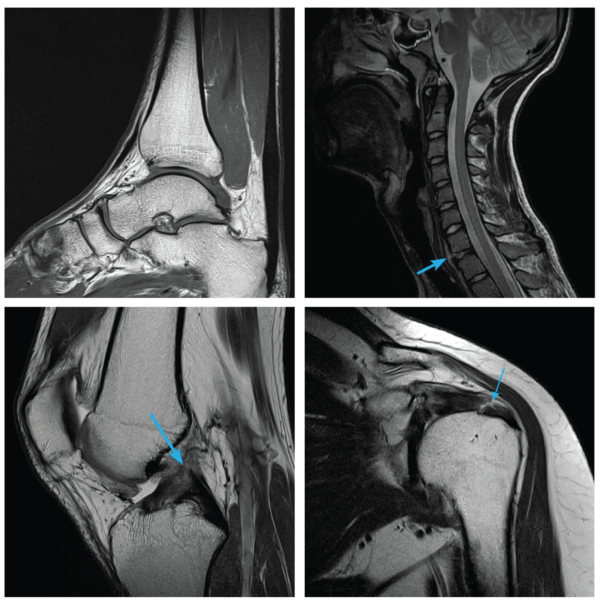 Cost Of Private Mri In Quebec