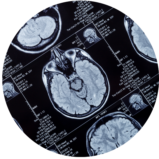 What is 3T contrast MRI?